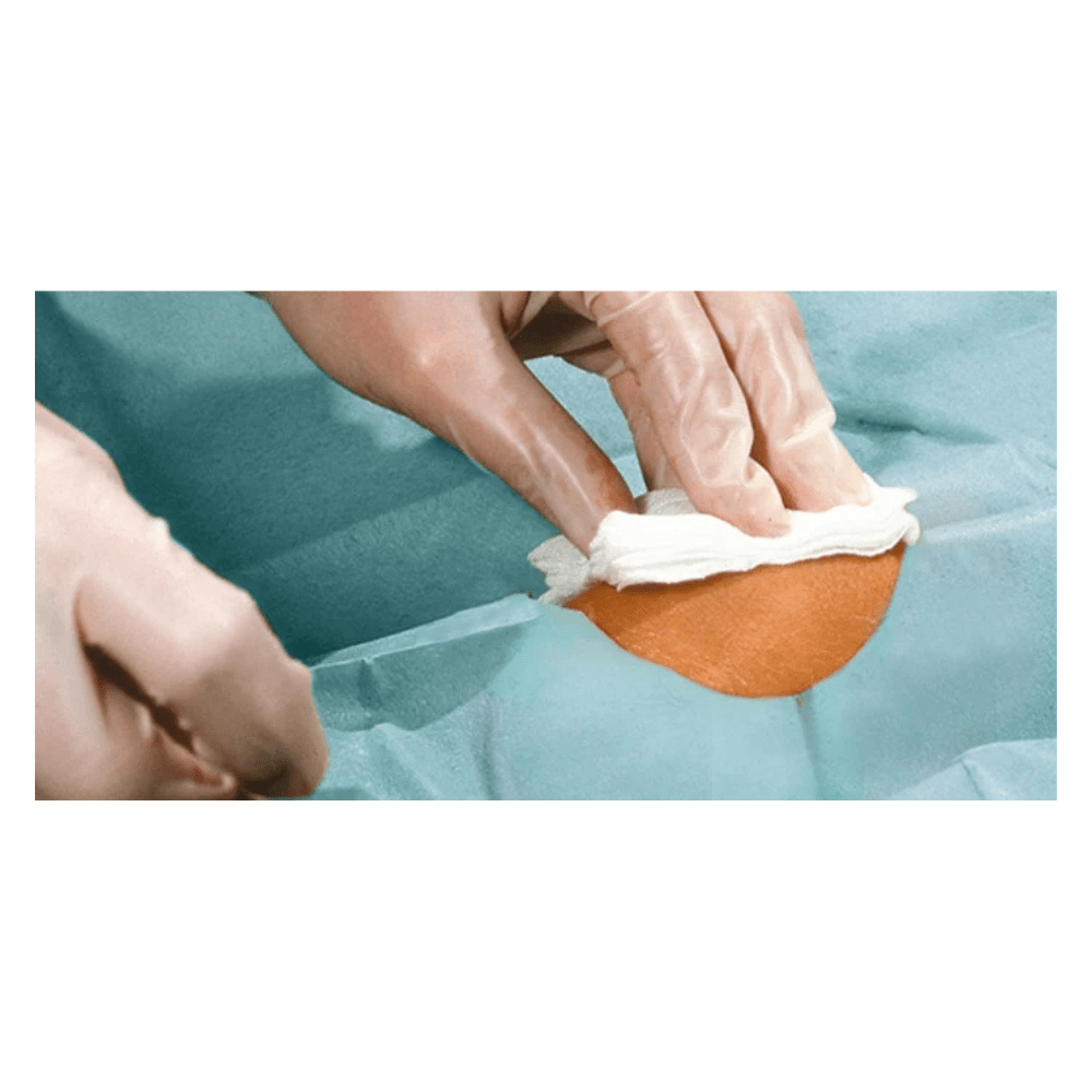 Hartmann Foliodrape® Protect Lochtücher selbstklebend steril, einzeln verpackt