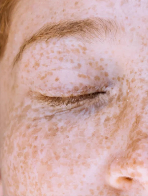 Dark Spot Face Cream with Kojic Acid
