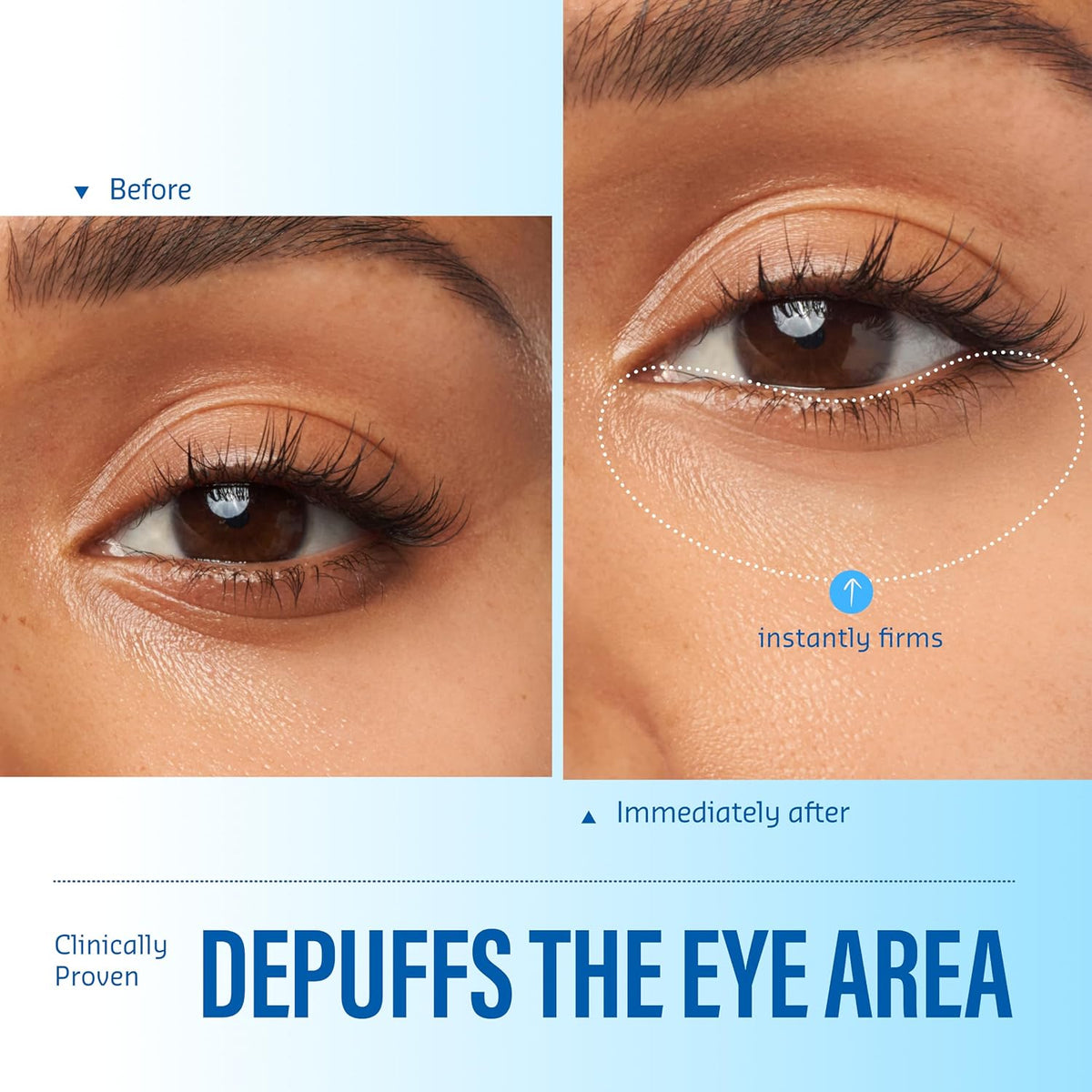 belif Aqua Bomb Eye Gel 15 ml