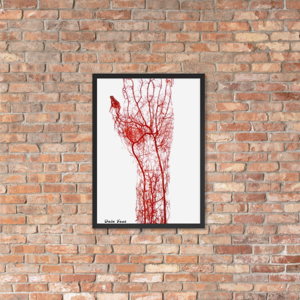 Personalisiere Dein Gerahmtes Poster
