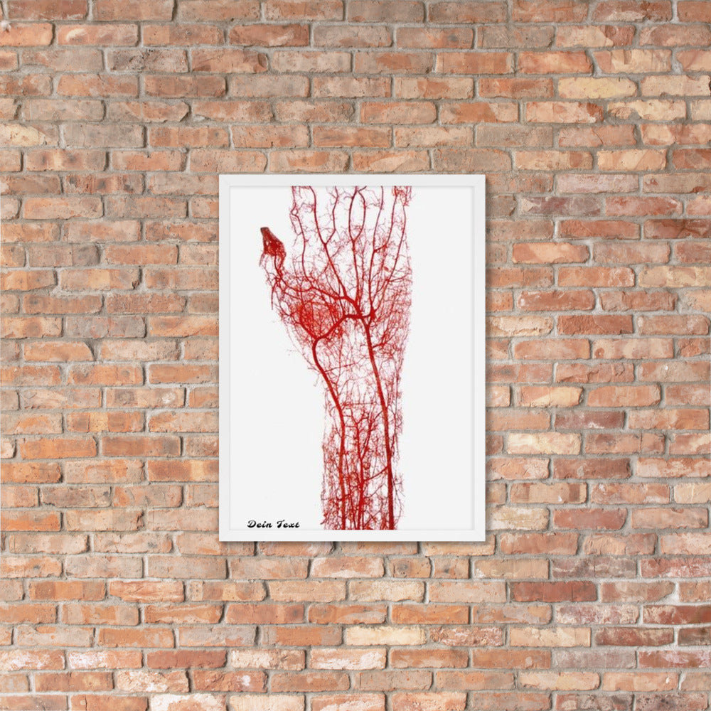 Personalisiere Dein Gerahmtes Poster
